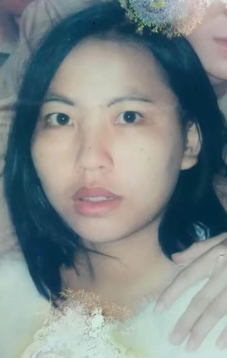 寻找邓美琼(曾用名邓丽),鼻子上有块刀疤有两颗大 于2002-08-15云南省红河哈尼族彝族自治州蒙自市失踪