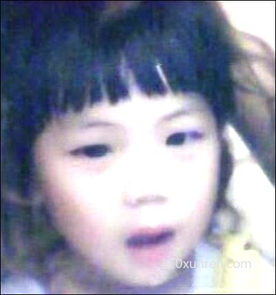 寻亲张佳佳:单眼皮肋骨上有道一寸 1996年2-3月份上海市宝山区宝山路失踪