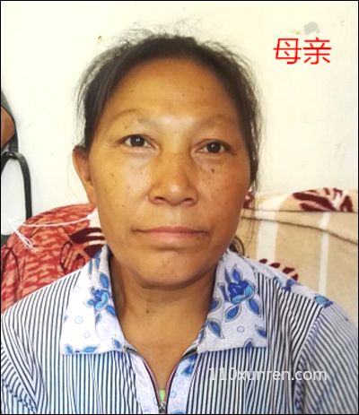 寻亲李林:双眼皮右手食指被砍了一 1991年03月17日贵州遵义市习水县东皇镇失踪