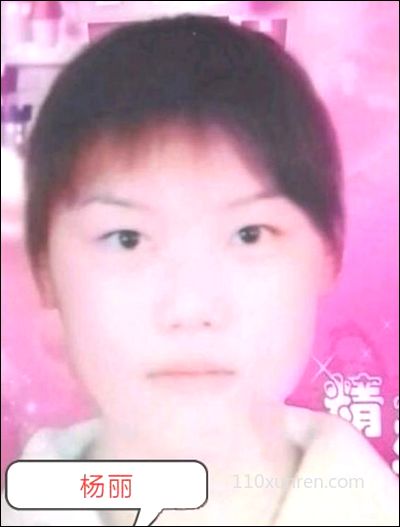 寻亲杨丽:右手食指有受伤后留下的伤 2007-07浙江省绍兴市失踪