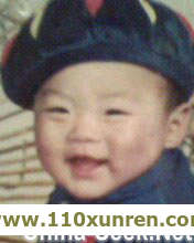 吉林李梦(失散亲友),患有小肠患气头发稀少皮肤白